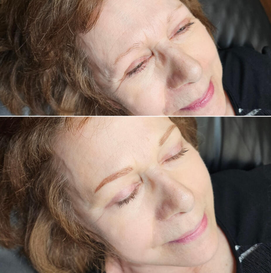 immediately after